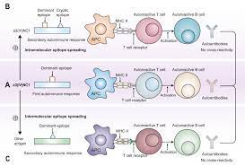 Glomerular Basement Membrane Disease