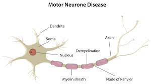 treatment of motor neuron diseases mnd