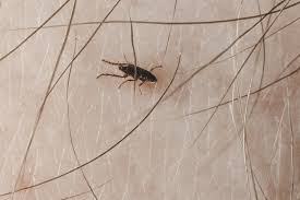flea bites identification symptoms