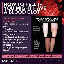 The good news concerning blood clots is that the ability to recognize early warning signs of a blood clot can keep you alive. Blood Clot How Do I Know If I Have A Blood Clot In My Leg Seven Symptoms Of A Blood Clot Express Co Uk
