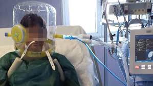 Can continuous positive airway pressure (cpap) make me sick? Helmet Niv Nippv Ventilation On Adult Covid 19 Patients