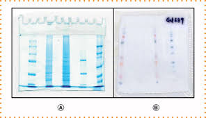 drying polyacrylamide slab gels