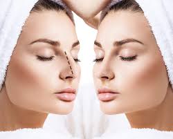 Check spelling or type a new query. The Difference Between Open And Closed Rhinoplasty Center