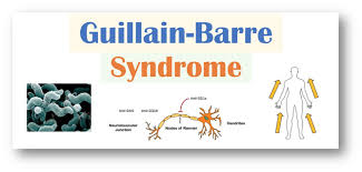 Yuki n., kokubun n., kuwabara s. An Introduction To Guillain Barre Syndrome Symptoms Causes Diagnosis And Treatment
