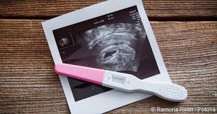 Ab wann ist ein schwangerschaftstest sicher? Schwangerschaftstest Ab Wann Er Aussagekraftig Ist Netdoktor