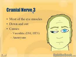 neuro cranial nerve 3 palsy you