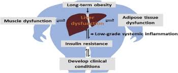 adipose tissue and insulin resistance