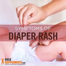 diaper rash characteristics causes