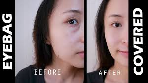 how to cover eyebags dark circles