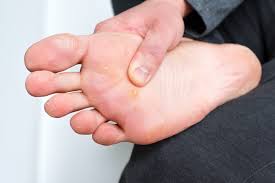 are plantar warts conious family