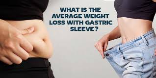 average weight loss with gastric sleeve