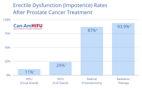 can am hifu prostate cancer solution