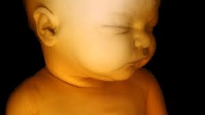 Image result for Photos of Trudeau with aborted babies