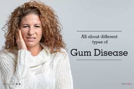 all about diffe types of gum