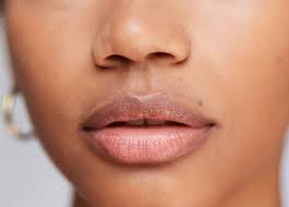 lip lift according to plastic surgeons