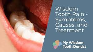 My Wisdom Tooth Dentist gambar png