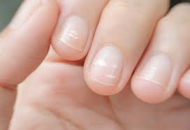 white spots on your child s nail