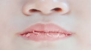 tips mengatasi bibir kering saat puasa