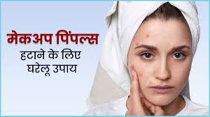 how to get rid of makeup acne in hindi