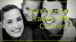 Cavities are permanently damaged areas in the hard surface of your teeth that develop into tiny openings or holes. Can You Get Braces With Cavities Green Meadow Dental