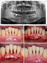 Waiting to have a dental visit only allows the problem to progress or worsen. Http Www Ijcem Com Files Ijcem0052237 Pdf