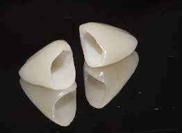 What Is A Porcelain Fused To Zirconia Pfz Dental Crown