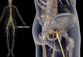 Sciatica Pictures Symptoms Causes And Treatments