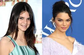 kendall jenner looks back at her ugly