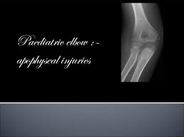 Related online courses on physioplus. Apophyseal Injuries Of Elbow Medial Epicondyle Avulsion Fractures