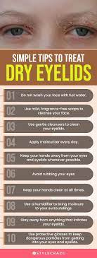 dry eyelids causes symptoms and