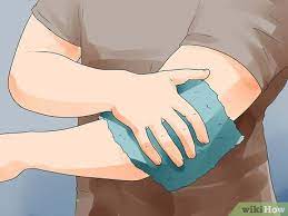 how to treat carpet burns with