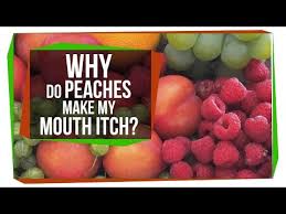 why do peaches make my mouth itch