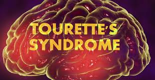 new treatment for tourette s what to