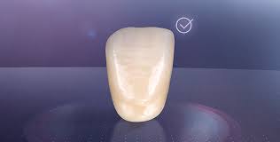 Vita Mft Anterior For Solid Standard Dentures With The