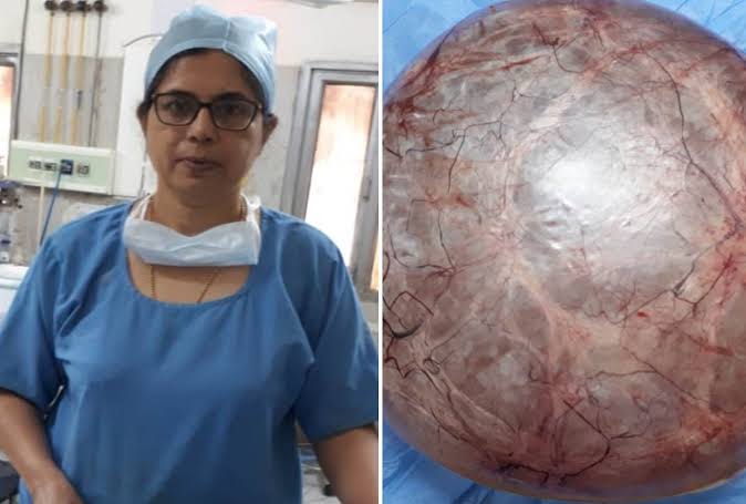 bloating-turned-out-to-be-1-5-kg-tumor-reality-tv-star-chanita-stephenson