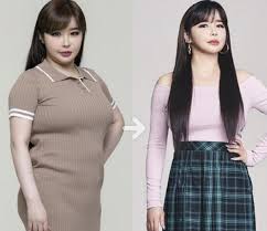 park bom s before and after photos