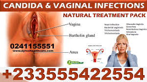 candida inal infections in ghana