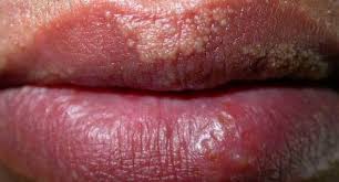 your lips say about your health