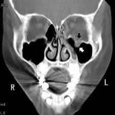 radiology in ped emerg med vol 6 case 9