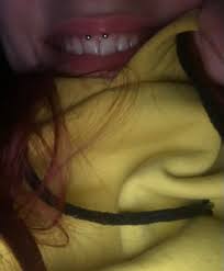 On the off chance that you adhere to your. I Got My Smiley Done 3 Days Ago But The Piercing Seems A Bit Crooked Does This Mean I Have To Get It Done Again Or Will It Become Straight After The