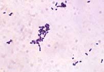 Gram stain or gram staining, also called gram's method, is a method of staining used to distinguish and classify bacterial species into two large groups: Tech Teasers October 2002 Tml Msh Microweb