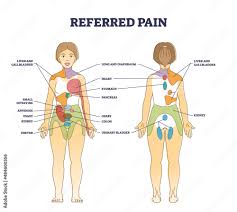 referred pain location as painful