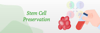 stem cell preservation in india know