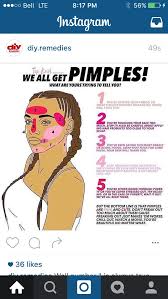 Pimple Chart In 2019 Pimple Chart Beauty Skin Pimples