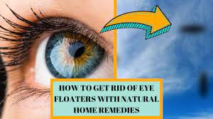 eye floaters with natural home remes