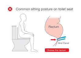 Correct Toilet Posture - Squat Easy