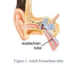 eustachian dysfunction treatment