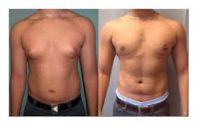 hgh for weight loss guide burn fat