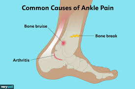 ankle pain causes treatment and when