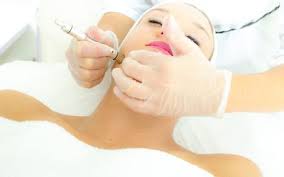 face skin benefits of microdermabrasion